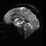 تصاویر فوق‌العاده دقیق قدرتمندترین دستگاه اِم‌آرآی جهان از مغز انسان